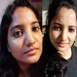 herbal-pure-product-9